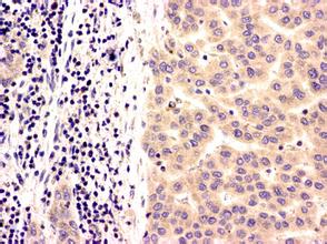 ����÷��MGM(�й���)��������