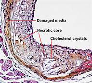 Ïû»¯ÏµÍ³¼²²¡Ä£×Ó Ïû»¯ÏµÍ³¼²²¡Ä£×Ó