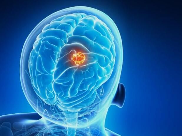 ����÷��MGM(�й���)��������