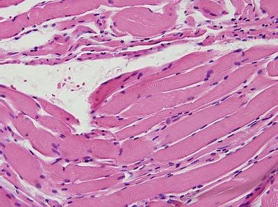 ����÷��MGM(�й���)��������