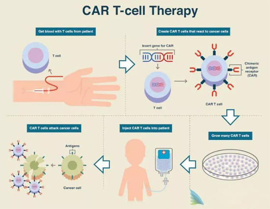 CAR-Tϸ���Ʒ�