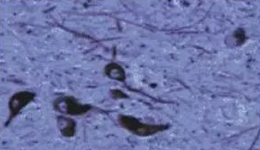 �����ˣ�������Ԫ����