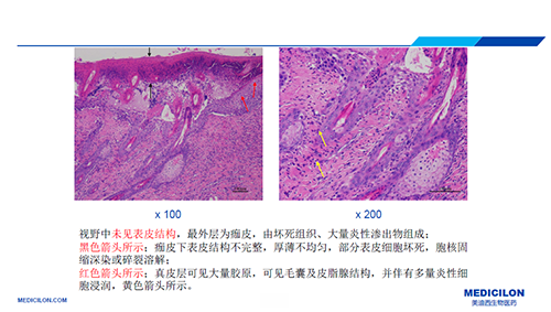 ��Ӧ��Ƥ�׵Ľ�ģ