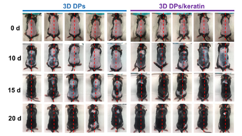 С��ë�����ֶȵ��Ӳ�ͼ