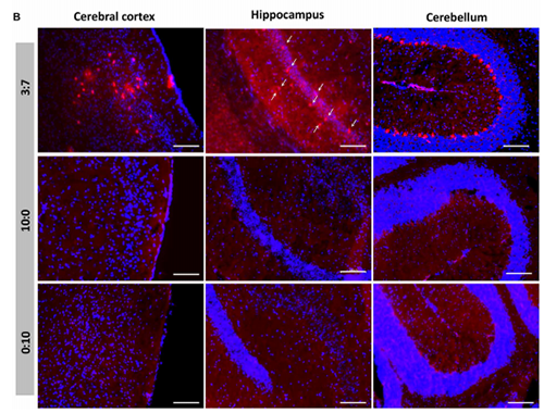 �������ں���NT-��֬�ʵ�LNP�е�Cre����ø�ֳ�ת�������������������е�תȾ��Ԫ�ʺ�ɫ����������������
