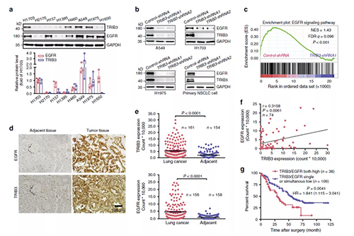 ÔÚÖ¸¶¨µÄNSCLCϸ°ûϵÖжÔTRIB3ºÍEGFR±í´ïµÄÃâÒßÓ¡¼£ÆÊÎö
