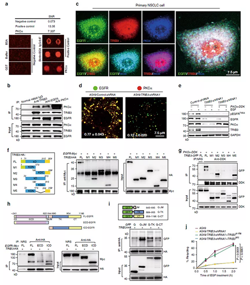 TRIB3ÓëEGFRÏ໥×÷ÓÃÒÔÔö½øPKC¦Á½éµ¼µÄEGFRÁ×Ëữ