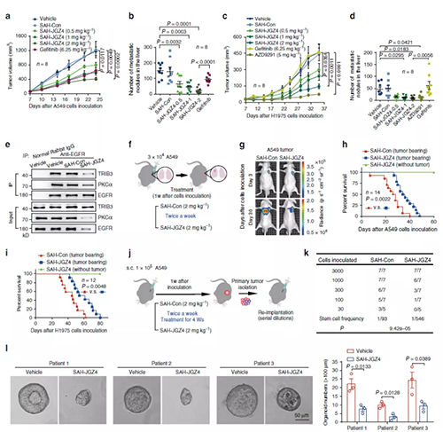 °ÐÏòEGFRÎȹÌÐÔÒÖÖÆ·Î°©µÄ±¬·¢ºÍÉú³¤