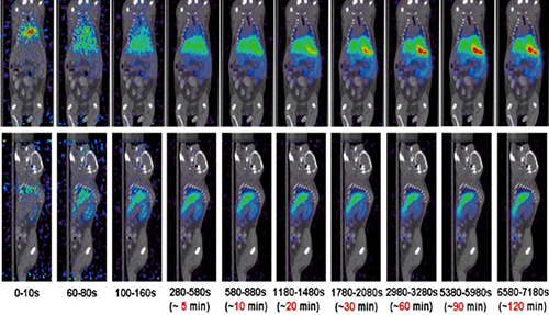 ÃÀ¸ß÷PET/CT·Ö×ÓÓ°Ïñ¼¼Êõƽ̨