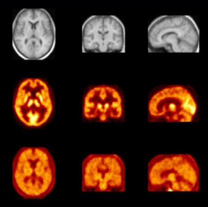 Ò©ÎïÔÚСÊó¸¹Ç»µÄ¶¯Ì¬ÂþÑܺÍÒ©ÎïÔÚÄÔµÄÇøÓòÂþÑÜ