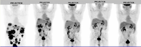 ʹÓÃPETÕ¹ÍûÒ©ÎïµÄºã¾ÃҩЧ