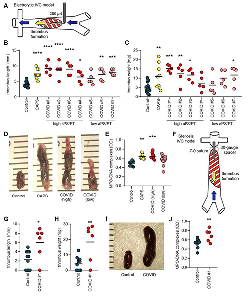 ����COVID-19���ߵ�IgG��ǿ��С���Ѫ˨�γ�