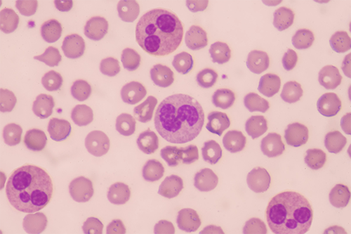 ѪҺ���¿��� 