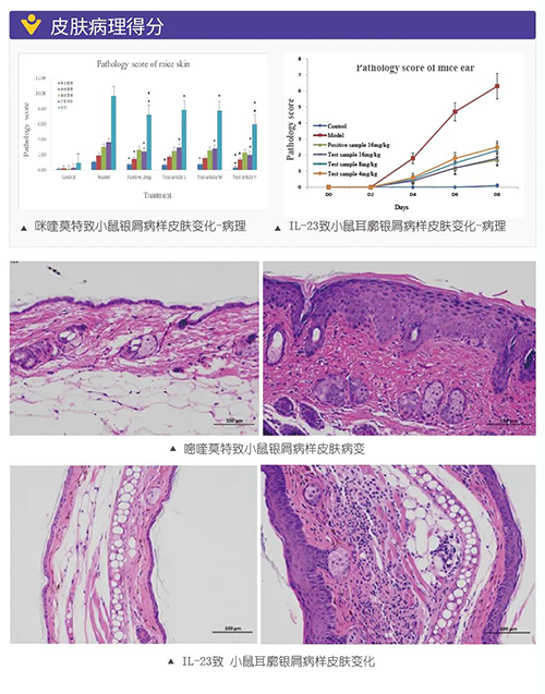 ���Ī����С����м����Ƥ��ת�䲡���÷�