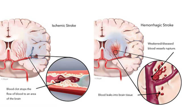 ���������գ��Ӷ���ҩЧģ�����ۿ�����Ѫ��ҩ�￪��