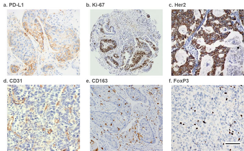 ÃâÒß×黯¼¼Êõƽ-°¸ÀýÉÍÎö.jpg ÃâÒß×黯¼¼Êõƽ-°¸ÀýÉÍÎö.jpg