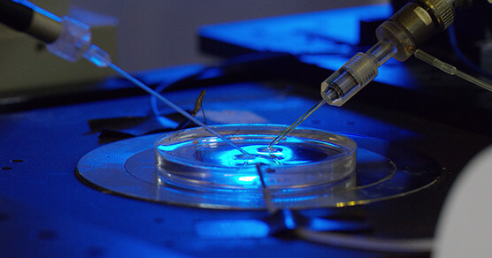 ������-2