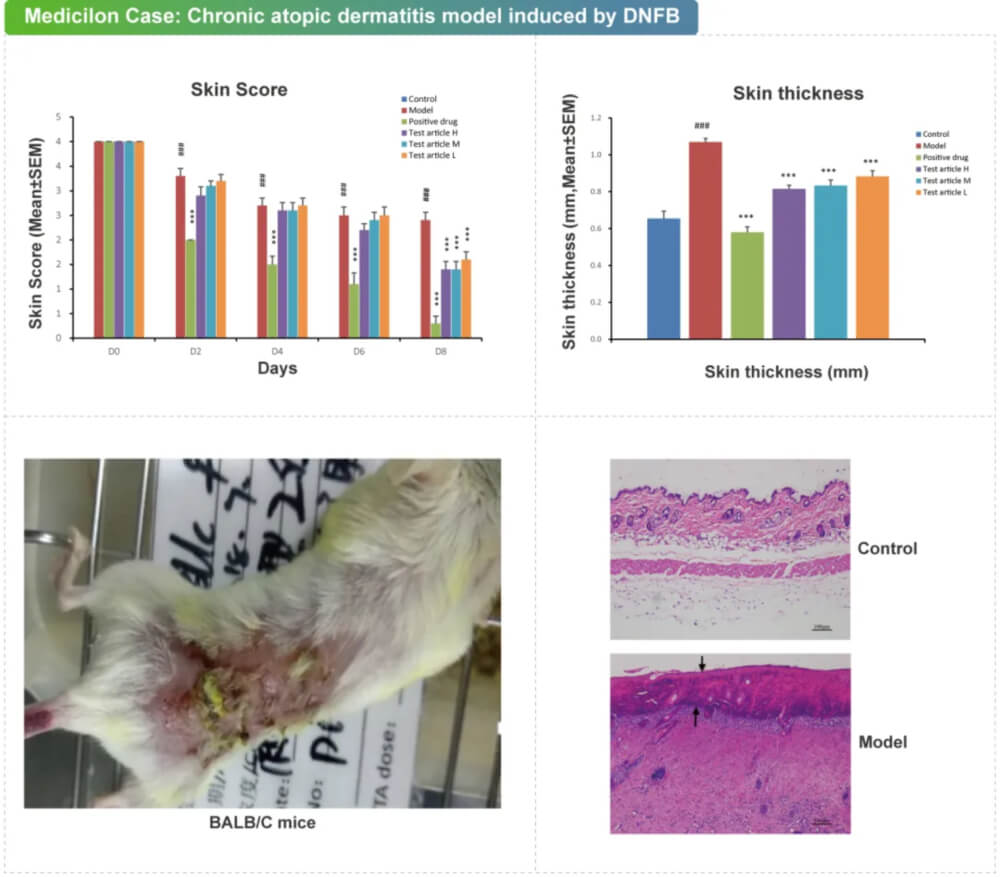 09 DNFB�յ���������Ӧ��Ƥ��ģ��.jpg