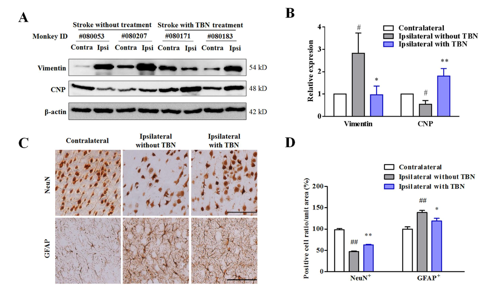 TBN��һ������ȱѪ�����е������ٴ���ѡҩ�����������������о���TBNͨ������÷�ϳ�